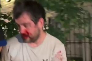 加掌大vs卡塔尔-3-被打到退出刺籍！“邓肯”惨遭纽约暴徒围殴！血流满面脱球衣保命